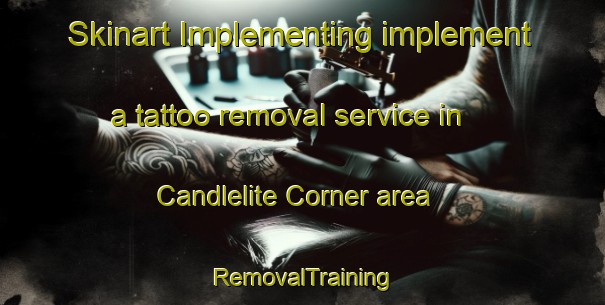 Skinart Implementing implement a tattoo removal service in Candlelite Corner area | RemovalTraining | RemovalClasses | SkinartTraining-United States