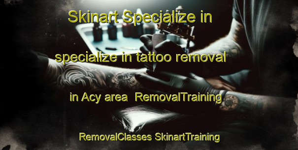 Skinart Specialize in specialize in tattoo removal in Acy area | #RemovalTraining #RemovalClasses #SkinartTraining-United States