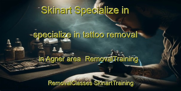 Skinart Specialize in specialize in tattoo removal in Agner area | #RemovalTraining #RemovalClasses #SkinartTraining-United States