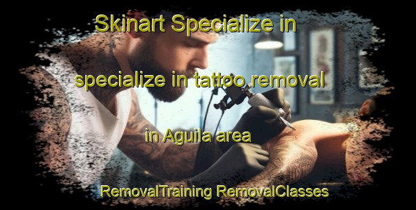 Skinart Specialize in specialize in tattoo removal in Aguila area | #RemovalTraining #RemovalClasses #SkinartTraining-United States