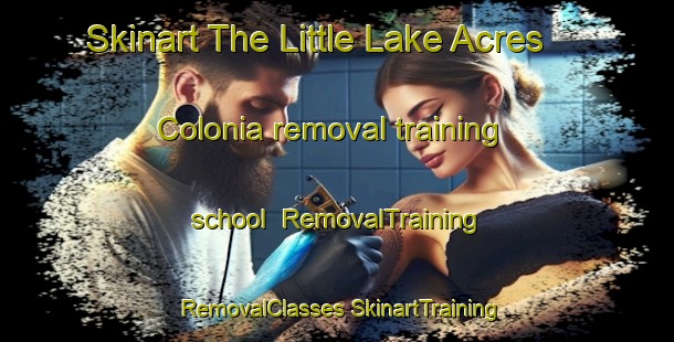 Skinart The Little Lake Acres Colonia removal training school | #RemovalTraining #RemovalClasses #SkinartTraining-United States